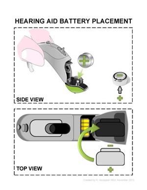 Hearing Aid Battery Placement 